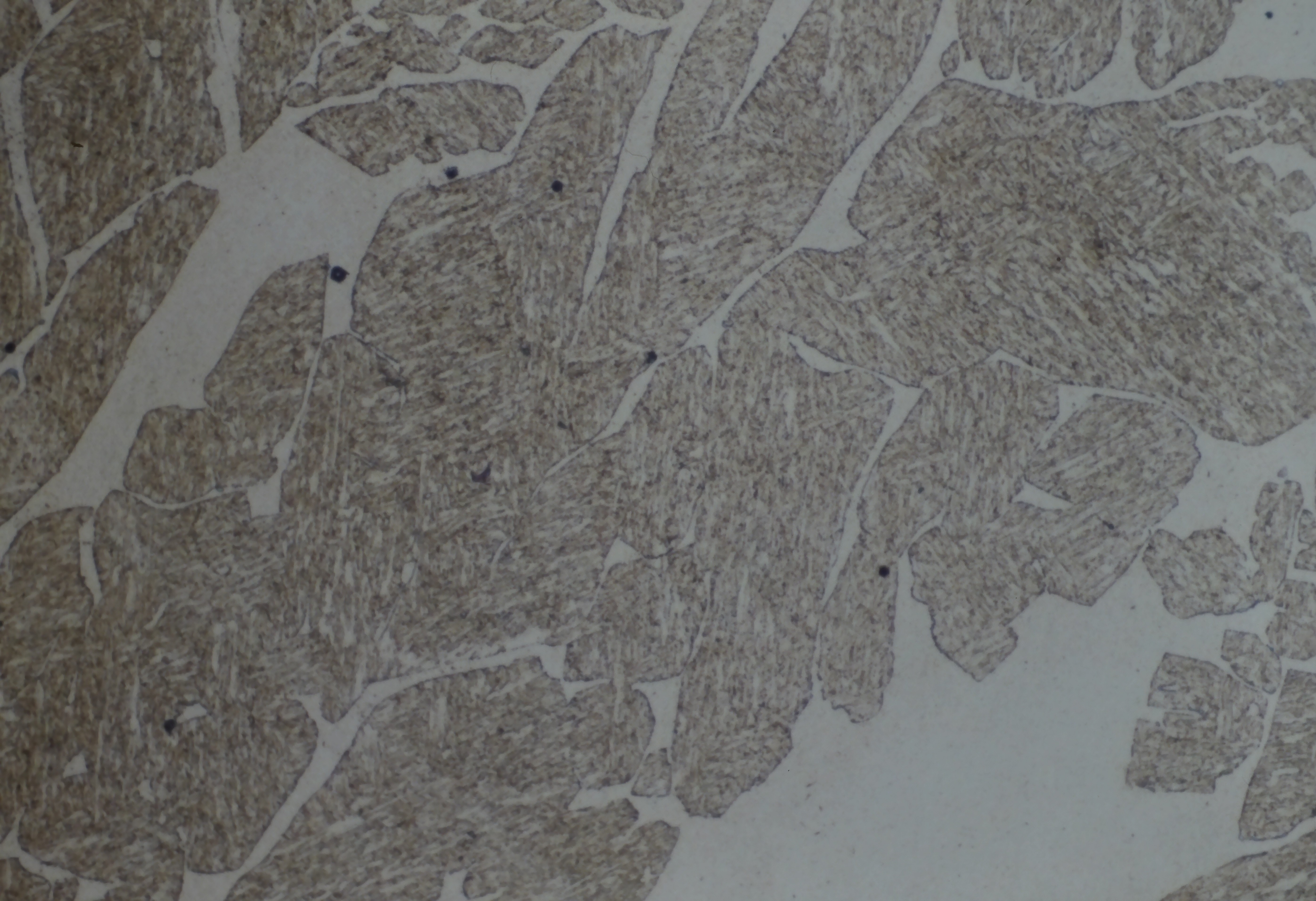 Stainless steel microstructure