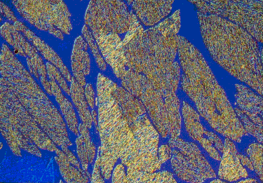 Stainless Steel Microstructure