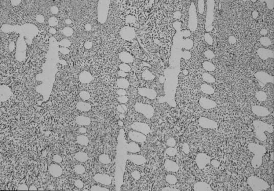 Aluminum-silicon cast alloy microstructure etched with Keller's reagent showing grain boundaries and silicon phase