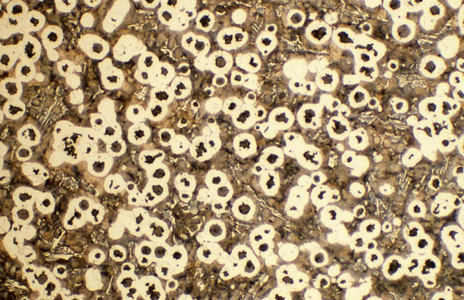 Nodular cast iron microstructure showing typical Class 3 material structure