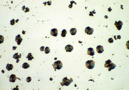 Nodular cast iron showing grain structure and nodular graphite