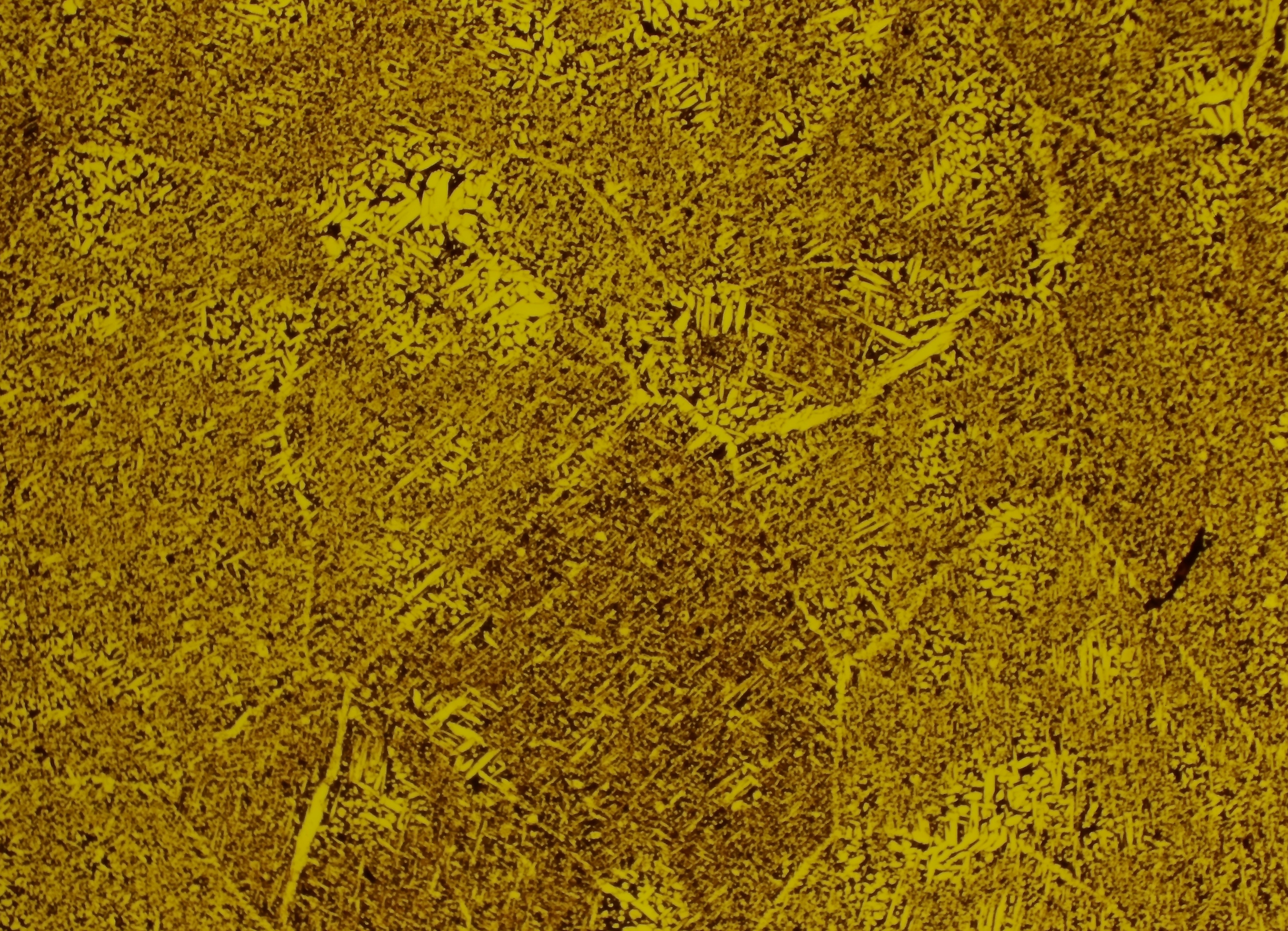 Aluminum-silicon alloy microstructure